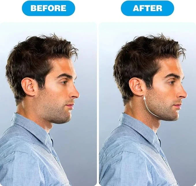 SharpJaw™-  Jaw Shaper & Facial Toner  | Sculpt, Shape & Lift | Compact Jaw Exerciser