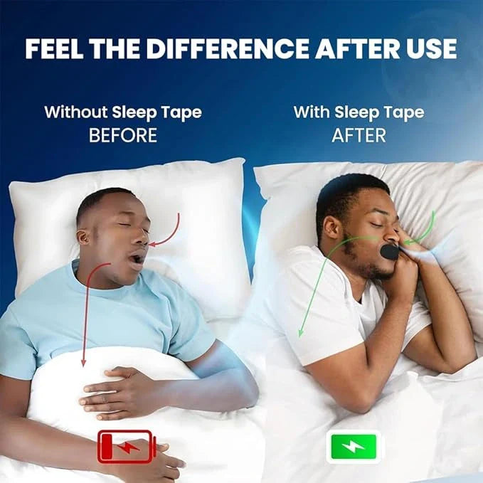 SilentBreathe™ (PACK OF 30!) –  Anti-Snoring Mouth Strips | Improves Breathing & Sleep | Reduce Snoring | Drug-Free & Instant Relief